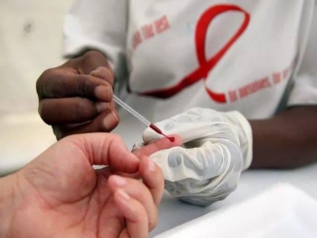 RD avanza en tratamiento del VIH, pero persisten barreras sociales y laborales